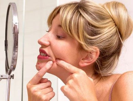 脸上长痘痘怎么破？ 这些护理细节你不可错过！