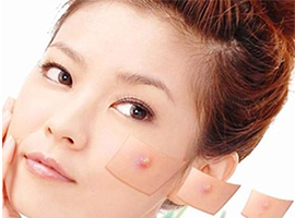 油性皮肤怎么祛痘？养成好习惯让痘痘不战而败