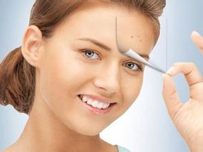 白头粉刺怎么去除?小妙招帮你补救肌肤