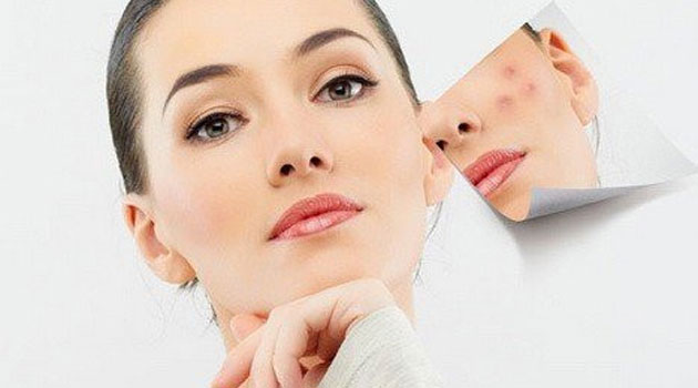 如何修复痘印痘坑?玛尚告诉你秘诀