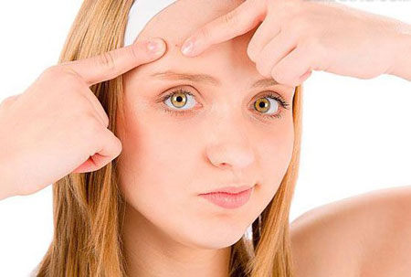 成人长痘的原因有哪些?这些坏习惯是&ldquo;主谋&rdquo;