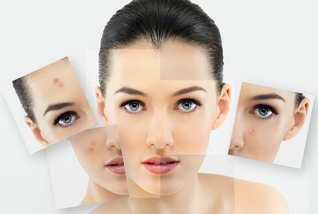 使用激素产品对皮肤有什么危害？