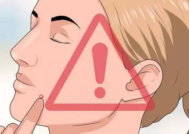 痘痘形成的原因有哪些?痘痘护理五步走!